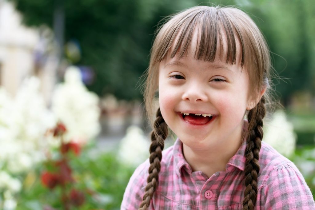 Yuk kenali perawatan yang tepat untuk anak dengan Down Syndrome