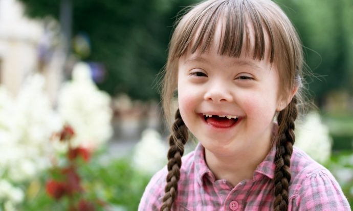 anak dengan Down Syndrome
